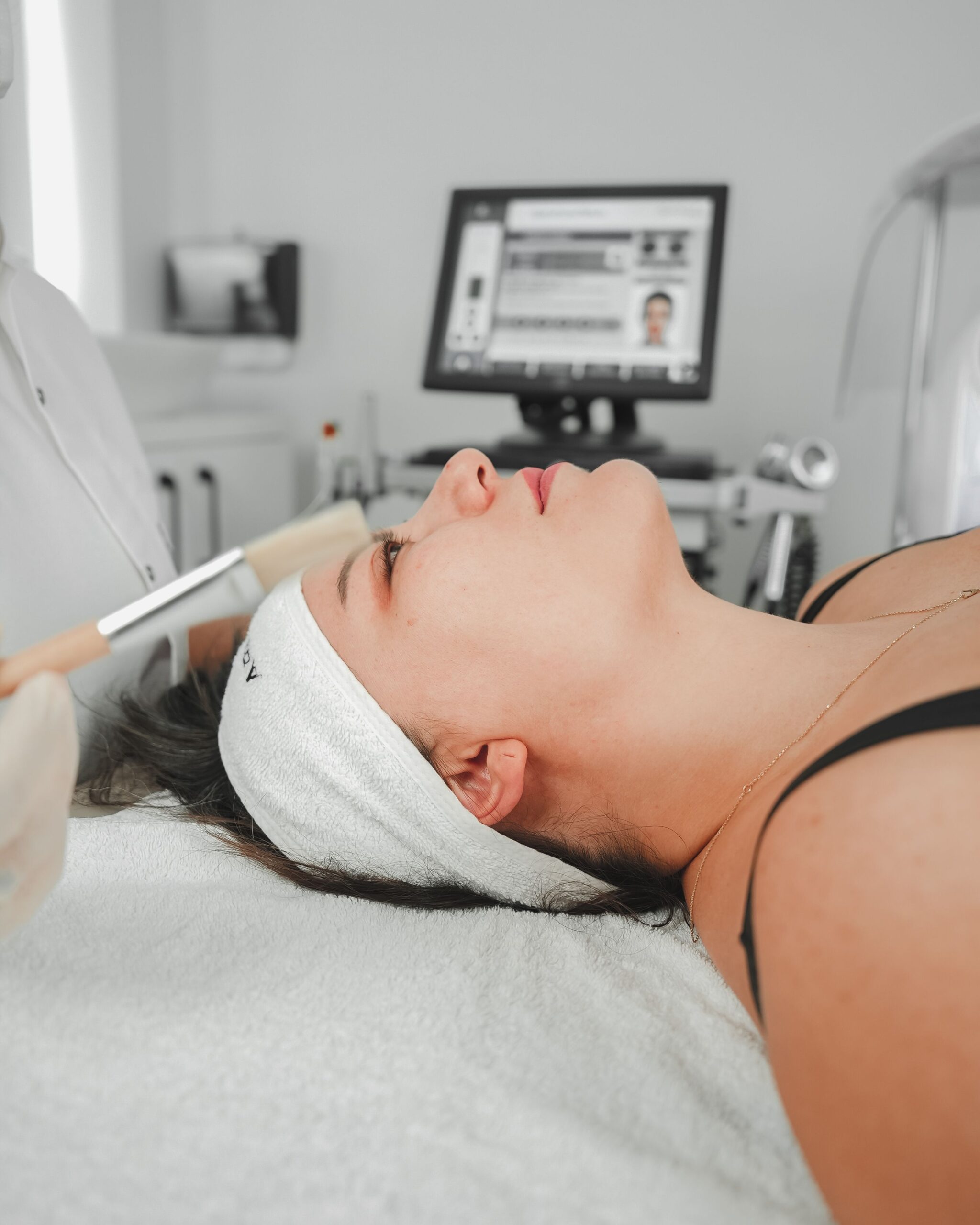 Chemical Peel